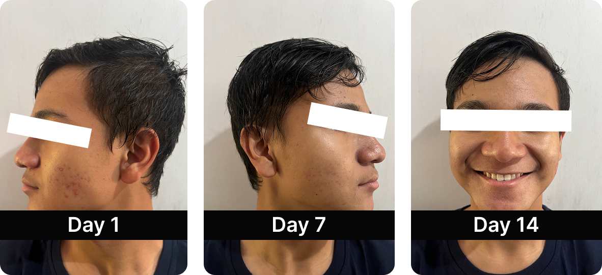 Before After Results